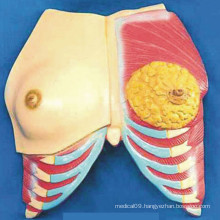 Human Breast Anatomy Model with Muscle and Ribs (R150102)